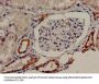 TBC1D4 Antibody