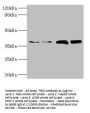 TBCC Antibody