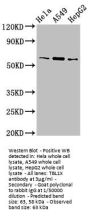 TBL1X Antibody