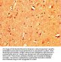 TBX3 Antibody