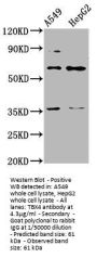 TBX4 Antibody