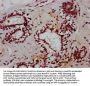 TCEA3 Antibody
