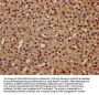 TCERG1 Antibody