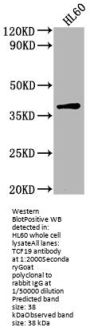 TCF19 Antibody