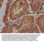 TCHH Antibody