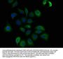 TCHH Antibody