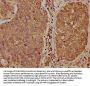 TCL1B Antibody