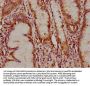 TCL1B Antibody