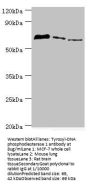 TDP1 Antibody