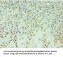 TDP1 Antibody