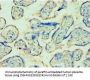 TDP1 Antibody