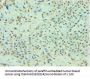 TDP1 Antibody