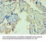 TDP1 Antibody