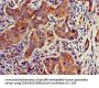 TECPR2 Antibody