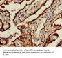 TERF1 Antibody