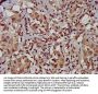 TFB1M Antibody