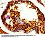 TFE3 Antibody