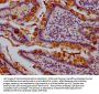 TFF3 Antibody