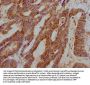 TFF3 Antibody