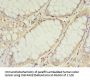 TIMM10 Antibody