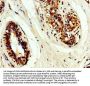 TIMP3 Antibody