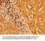 TM6SF2 Antibody