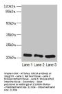 GM2A Antibody