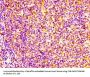 GM2A Antibody