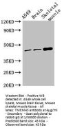 TMEM43 Antibody