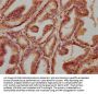 TMEM87B Antibody