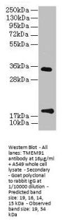TMEM91 Antibody