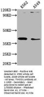 TMOD1 Antibody