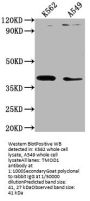 TMOD1 Antibody