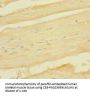 Rabbit anti-human Tumor necrosis factor-inducible gene 6 protein polyclonal Antibody