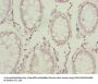 ENO1 Antibody