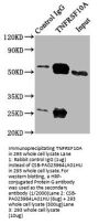 TNFRSF10A Antibody
