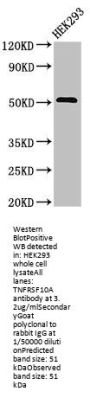 TNFRSF10A Antibody