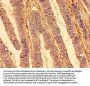 TNFRSF10A Antibody