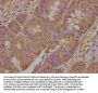 TNFRSF1A Antibody