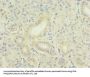 TNFSF12 Antibody