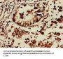 TNIK Antibody