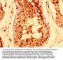 TNKS Antibody