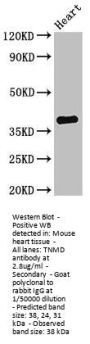 TNMD Antibody