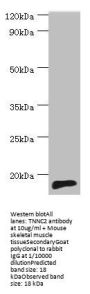 TNNC2 Antibody