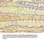 TNNC2 Antibody