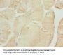 TNNI2 Antibody