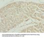 TNNI2 Antibody