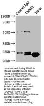 TNNI2 Antibody