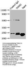 TNNI2 Antibody