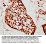 TNP2 Antibody